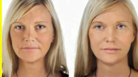 life extension skin restoring 350mg phytoceramides